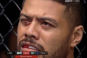 Justin Tafa Eye Poke - UFC Fight Night